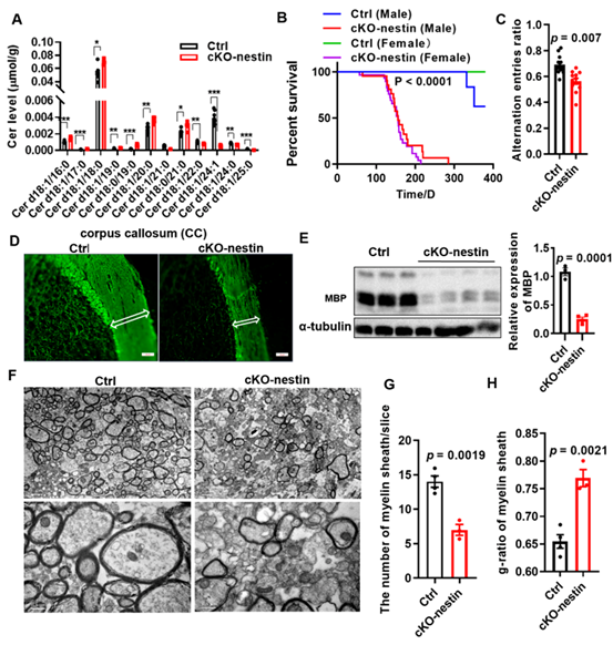 税光厚研究组揭示超长链鞘脂在髓鞘发育中的关键作用及相关机制